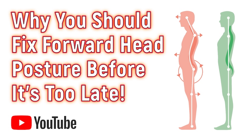 Forward Head Posture