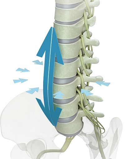 non-surgical spinal decompression